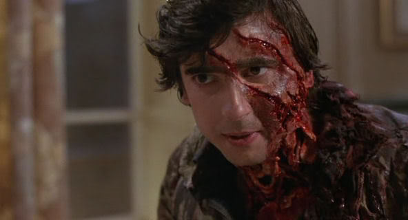 an-american-werewolf-in-london-jack-slashed